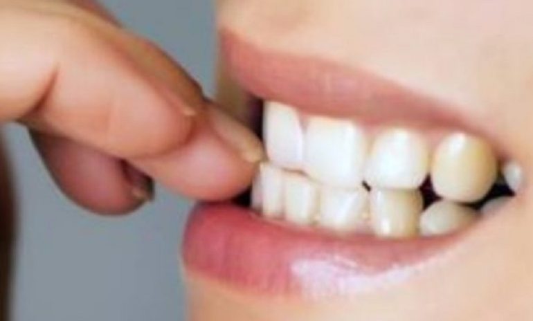 Denti: allo studio farmaco che li fa ricrescere
