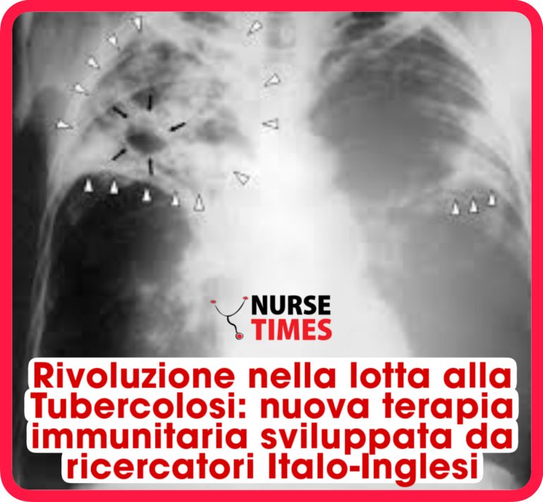 Rivoluzione nella lotta alla Tubercolosi: nuova terapia immunitaria sviluppata da ricercatori Italo-Inglesi