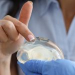 Protesi mammarie, ribadito il divieto di impianto a soli fini estetici per le minorenni