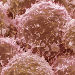 Tumore al polmone, microbot per la somministrazione di farmaci testati in modo sicuro sui topi