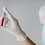 Alzheimer: nuovo test del sangue per una diagnosi accurata al 90%