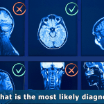 Diagnosi medica: potenziale e limiti dell'intelligenza artificiale