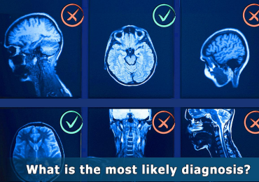 Diagnosi medica: potenziale e limiti dell'intelligenza artificiale