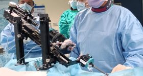 Per la prima volta in Italia riparata la valvola mitrale grazie a un anello chirurgico introdotto per via percutanea
