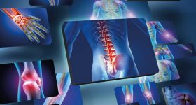 Scoperto ormone che rafforza le ossa: nuovo alleato nella cura di fratture e osteoporosi
