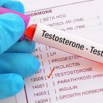 Testosterone, cambiano i criteri per misurarlo: oltre al dosaggio nel sangue, contano obesità, diabete e pressione alta