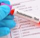 Testosterone, cambiano i criteri per misurarlo: oltre al dosaggio nel sangue, contano obesità, diabete e pressione alta