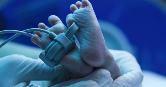 Ipoglicemia neonatale transitoria: diagnosi e trattamento