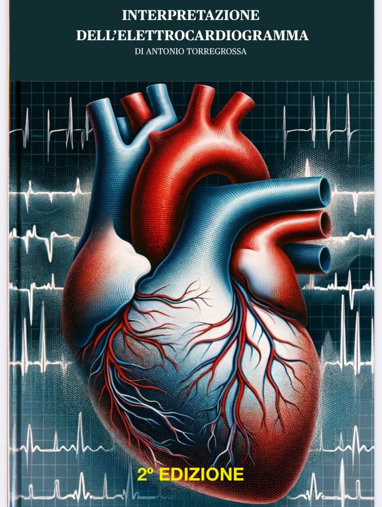 Recensione dell’eBook “Interpretazione dell’Elettrocardiogramma – Seconda Edizione”. Scaricalo gratuitamente