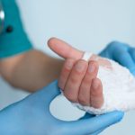 Ferite cutanee, identificata molecola chiave per la guarigione