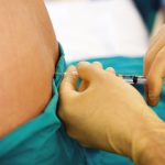 Rachicentesi: procedura, utilizzi, rischi e gestione del paziente