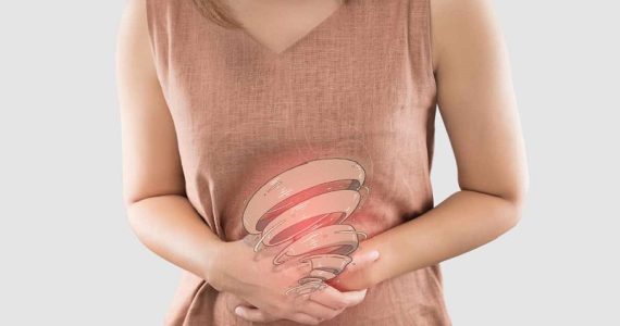 Sindrome dell'intestino irritabile: difetti genetici nella digestione dei carboidrati influenzano la risposta alla dieta