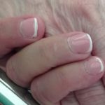 Alzheimer: famiglie in difficoltà. Urge sostegno concreto