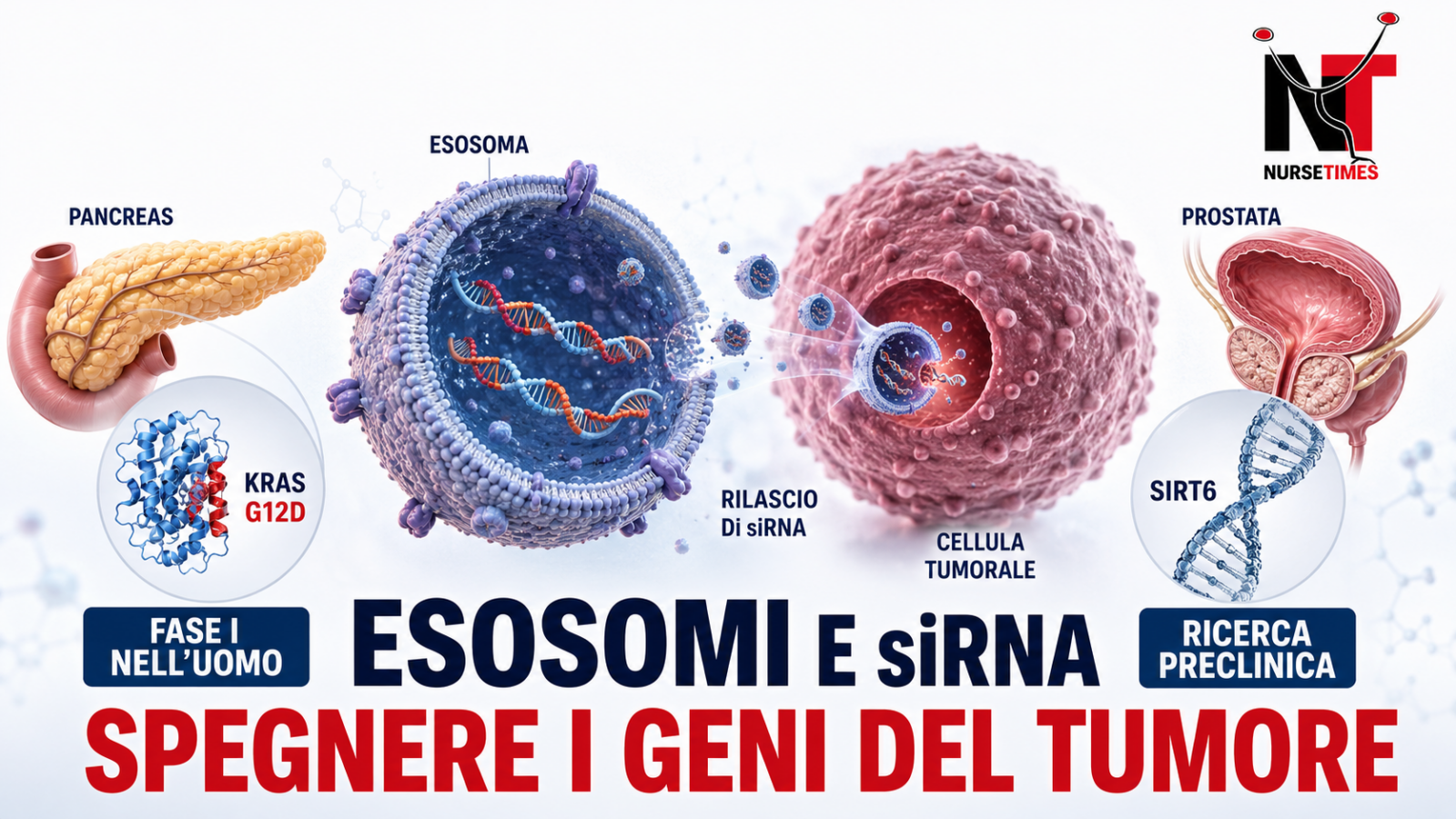 Esosomi con siRNA diretti contro geni tumorali nel tumore del pancreas e nella ricerca preclinica sul carcinoma prostatico